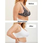 UPFORMA